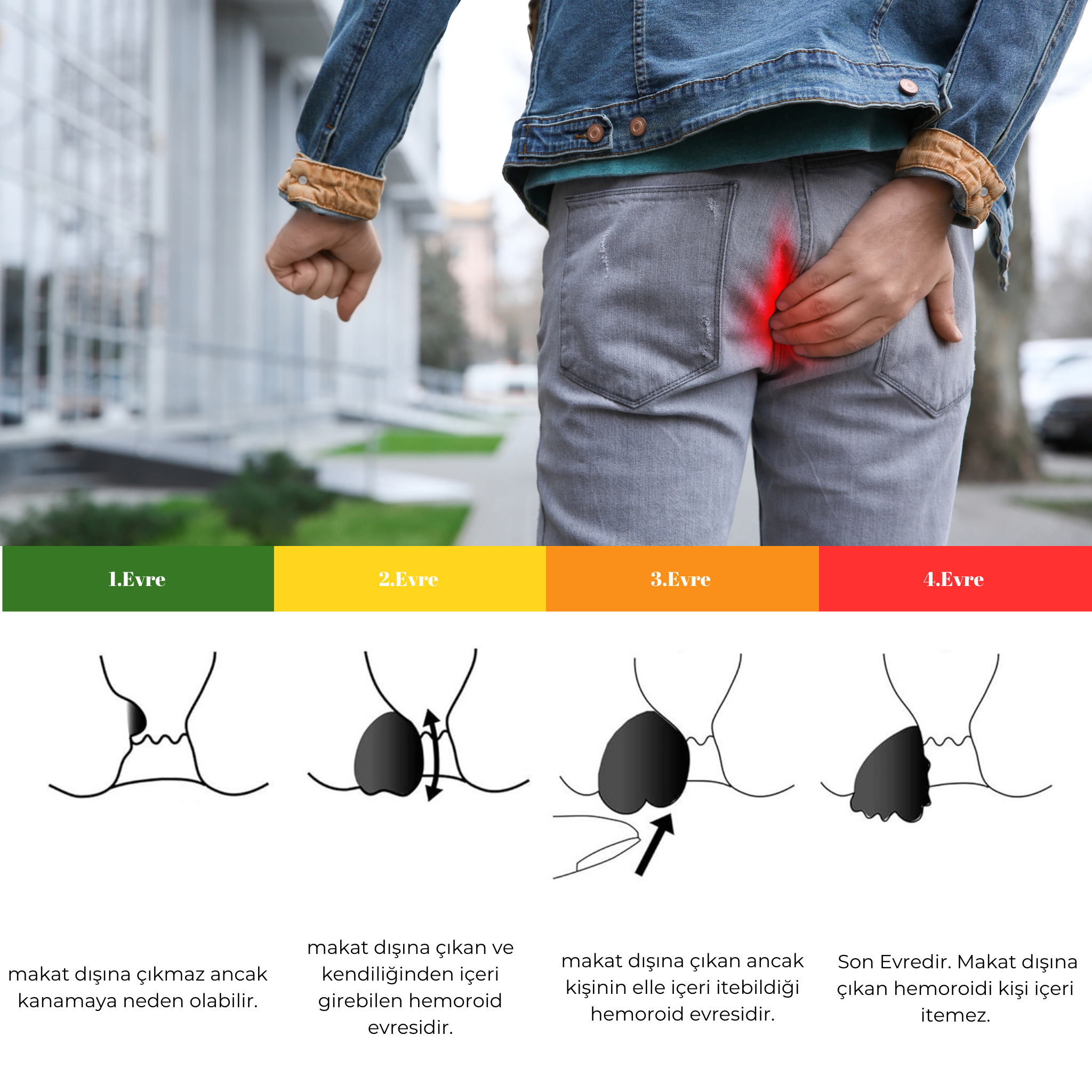 AnaThol Sprey + AnaThol Onarıcı Bakım Kremi Avantajlı Set